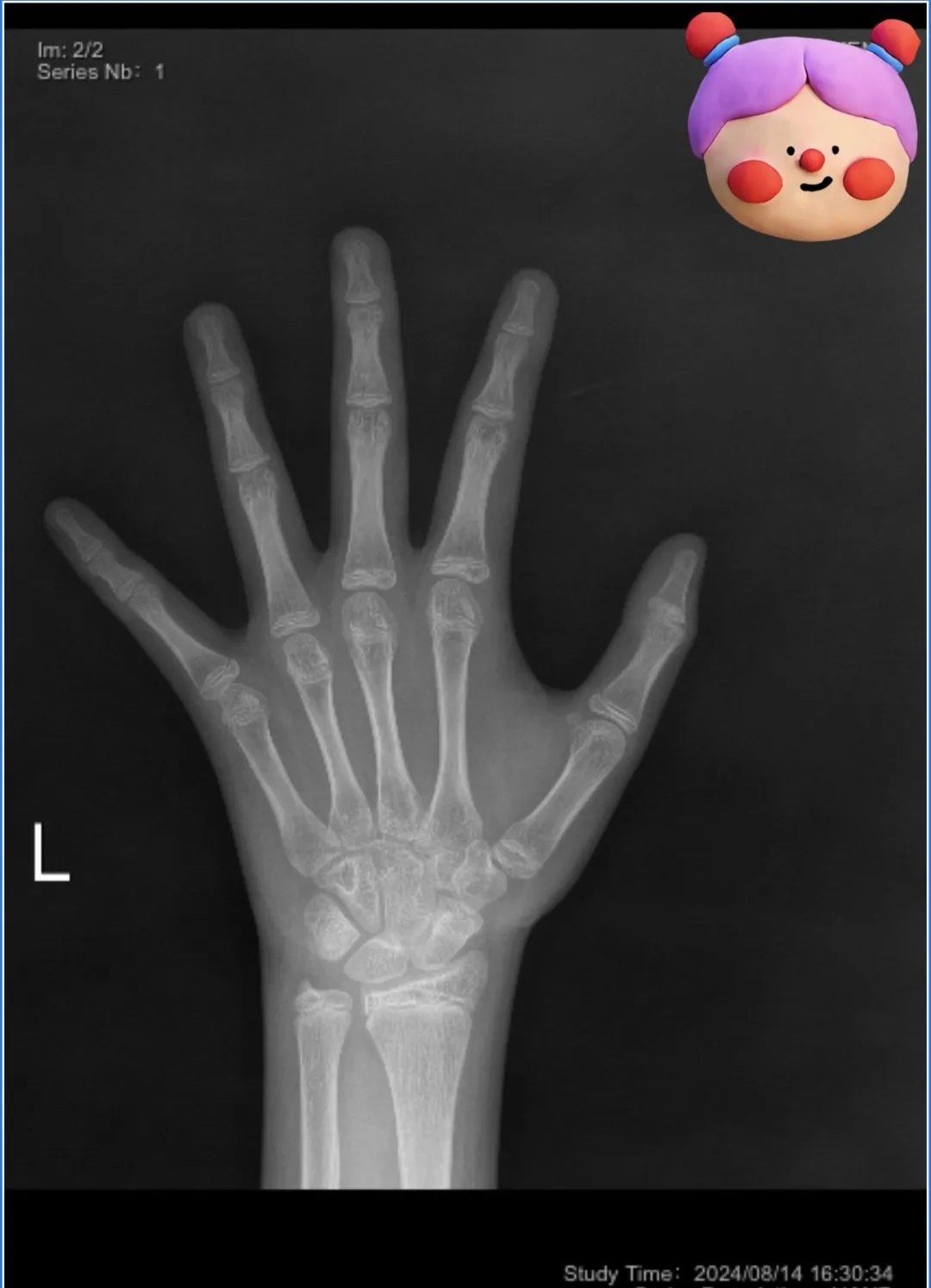 最害怕的事还是发生了!