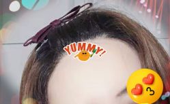 -大麦微针植发全国连锁