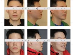 -齐玉齿科JADENTAL