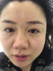 -紫御国际抗衰ZOE ANTI AGING