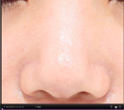 -韩国淼美颜皮肤管理官方直营店