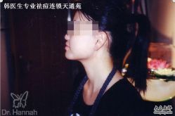 -韩医生专业祛痘连锁机构