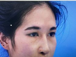 -西安壹加壹医疗美容·西北抗衰旗舰店