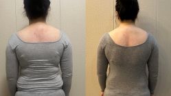 -摩瘦纤体订制减肥