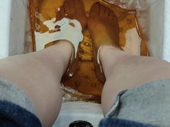-Andrew指甲专科灰指甲·甲沟炎矫正·3D步态矫形鞋垫定制(浦三路店)