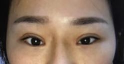 体验后-天津伊美尔医疗整形美容专科医院