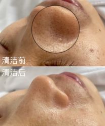 -春田皮肤管理中心品牌旗舰店