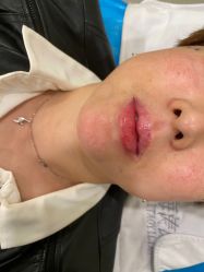 -海涛医疗美容·面部抗衰·注射美鼻