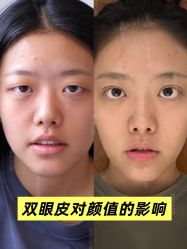 -Yestar重庆艺星医疗美容医院