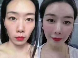-MOE BEAUTY.皮肤管理中心