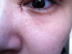 第四天-上海华安整形外科门诊部