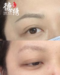 -德绣·机器野生眉发际线·美瞳线半永久