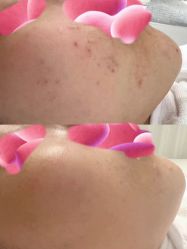 -康美贞·痘肌养护管理中心