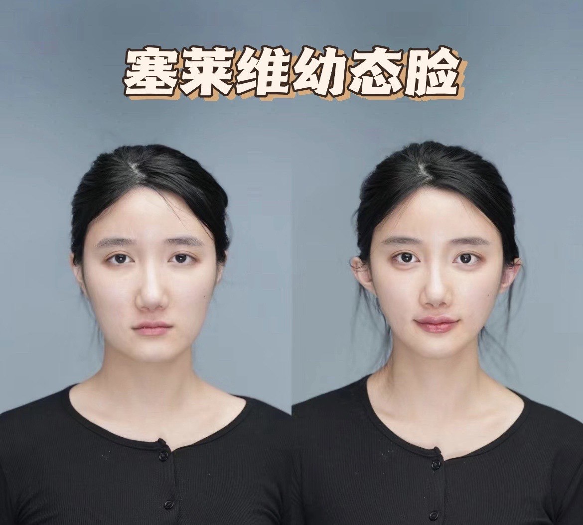 https://qcloud.dpfile.com/pc/SDMLnWaRHWPz-A9n54--7brKOOiCQf1EXkYu9-AXZ33XHfQn-RxdPR9yijF_p2VdY0q73sB2DyQcgmKUxZFQtw.jpg