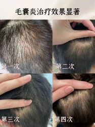 -希梵尔头皮抗衰·科技养发