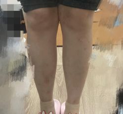 体验后-重庆军科整形美容医院