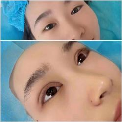 -郡艺医疗美容·微整·眼鼻吸脂