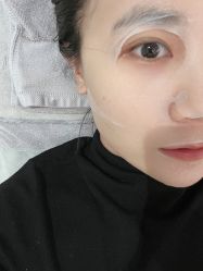 体验后-纯粹医美
