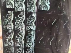 -通透堂中医·精准推拿(旗舰店)