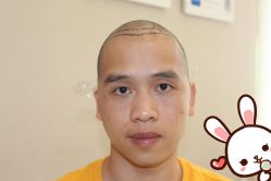 -大麦微针植发丨全国连锁