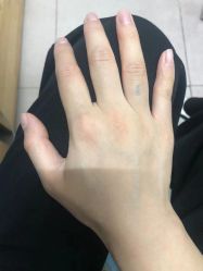 -天道专业洗纹身