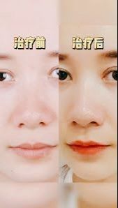 点击看大图 -SKINIST丽铂医疗美容