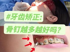-极光口腔·矫正种植修复(锦江店)