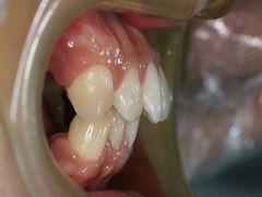 -同步齿科·数字化正畸种植口腔中心(珠海店)
