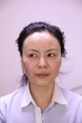 -北京叶子整形美容医院