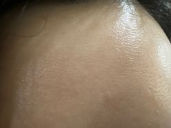 -广州美莱医疗美容医院