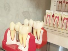 -上海仁爱医院口腔科 · 种植