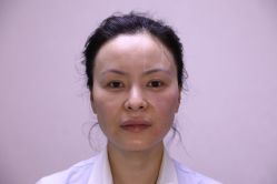 -北京叶子整形美容医院