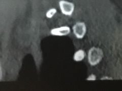 -成都市第一人民医院(南区)