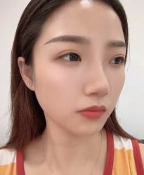 -天津健丽·去眼袋医疗美容机构