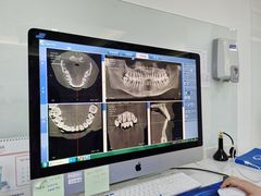 -Dr.Z dental仁康种植矫正中心