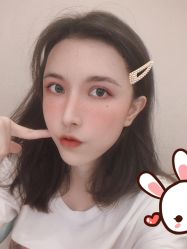 点击看大图 -大麦微针植发丨全国连锁