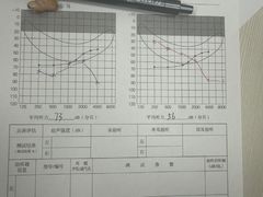 -惠耳听力助听器(奉贤南桥店)