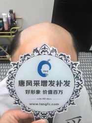 -唐风采假发补发定制