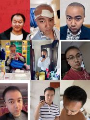 -雍禾植发全国连锁