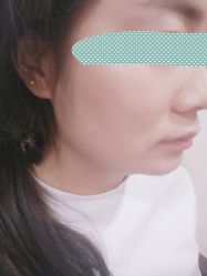 点击看大图 -北京美痣堂古方祛痣斑疣瘊