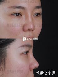 -北京米扬丽格医疗美容·联合丽格鼻整形中心