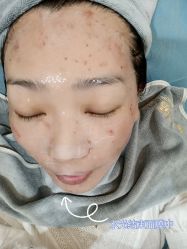 体验后-北京英煌医疗美容