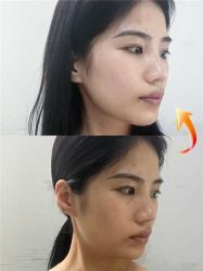 -上海伊莱美医疗美容医院