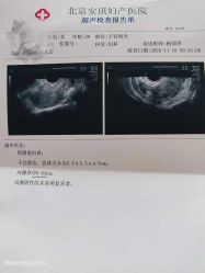 -北京安琪