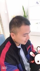 -大麦微针植发丨全国连锁