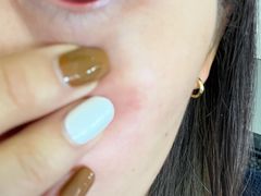 -昆明爱尔眼科医院