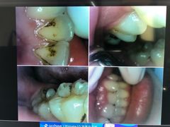 -同步齿科·数字化正畸种植口腔中心(珠海店)