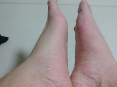 -深蓝盲人按摩中心(西北旺店)