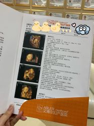 -艾博尔医院