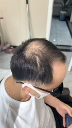 -唐风采假发补发定制